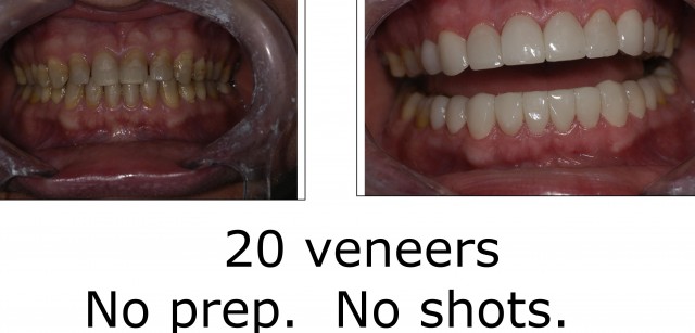 Slide 5 AP
